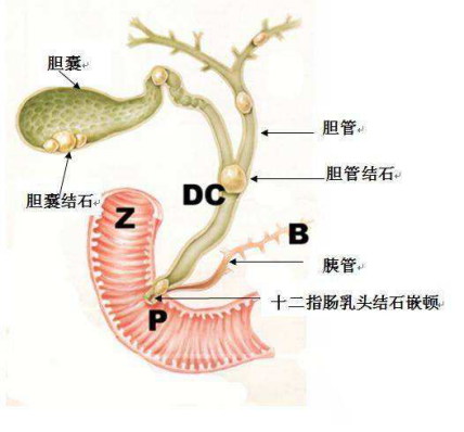 胆道解剖示意图