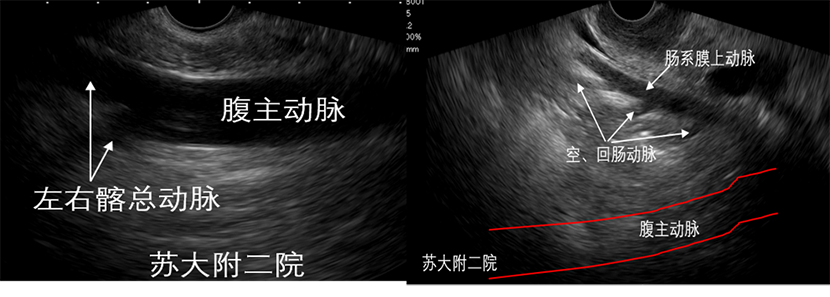 图9降部探查1.png